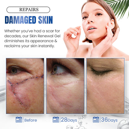 SilVive™ Advanced Silicone Skin Renewal Gel